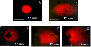 Днк кометы. Метод ДНК-комет (Comet Assay). Метод ДНК комет схема. Метод ДНК комет этапы. Обозначьте правильную последовательность этапов метода ДНК комет.