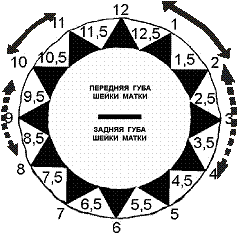 Центрическая схема характерна для