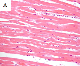 Рисунок 10 б Native Heart 40x HE paraffin.tif,А