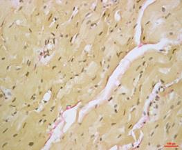 Рисунок 10 б Native Heart 40x HE paraffin.tif