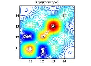 Ковариация_РНК_уровни_кардиосклероз.png