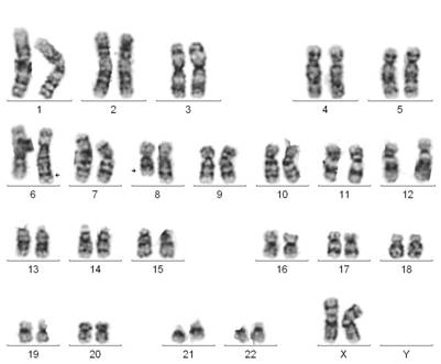 Транслокация хромосом фото
