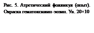 Подпись: Рис. 5. Атретический фолликул (опыт). Окраска гематоксилин-эозин. Ув. 20×10