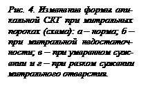 Подпись: Рис. 4. Изменение формы апи-кальной СКГ при митральных по¬роках (схема): а – норма; б – при митральной недоста¬точ-ности; в – при умеренном суж-ении и г – при резком сужении митрального от¬верстия.