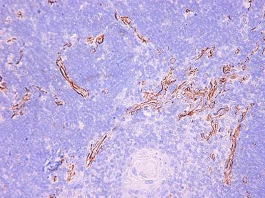 Описание: Описание: D:\все по тимусу\белый и синий пороки\виментин+cd34\Новая папка\P1010146r.JPG
