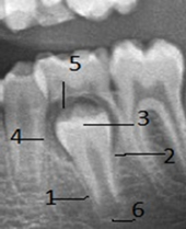 Рентгенологическая картина зубов и их зачатков на различных этапах формирования