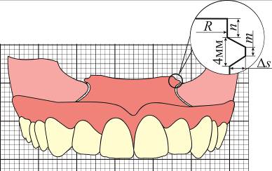 fig2