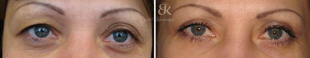 http://www.cosmomed.ru/ba/13/02/bl009-1_b.jpg