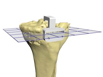 Dyuhina_3d_knee.jpg