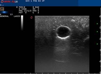 Рисунок3