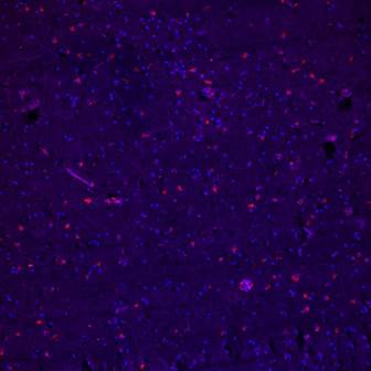 Brain_#42-15_dopamine receptor (rab_green)+CD34(mouse-red)_x20_3