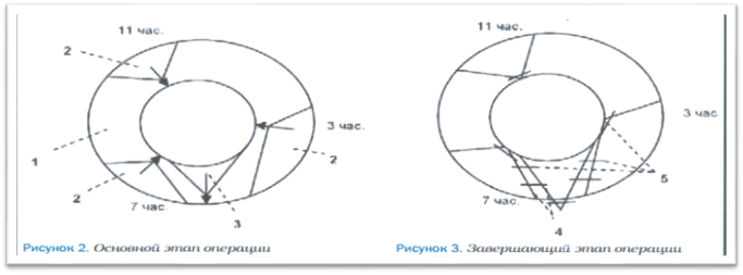 рис2 - 0012