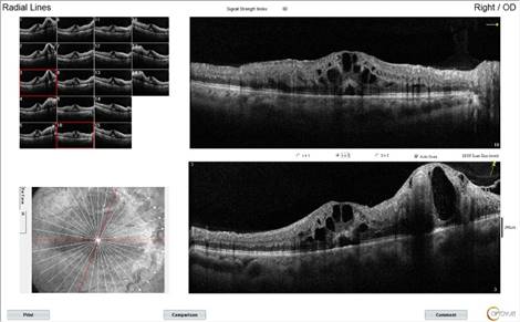 _Grigoryan_Raisa__27713_Radial Lines_OD_2020-07-10_13-21-14_F_1976-03-25_Main Report