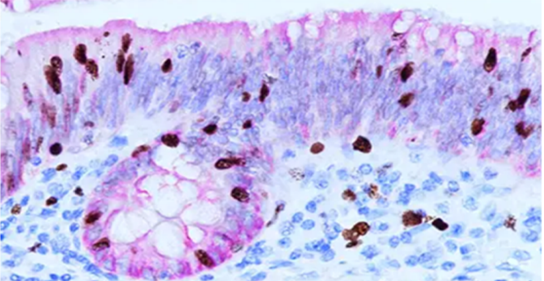 загрузка (1)