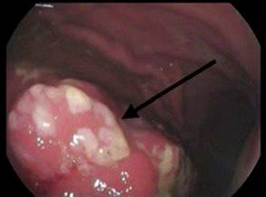 cd1a6010-2001-4c8a-8fc5-41b7b95ae1c6