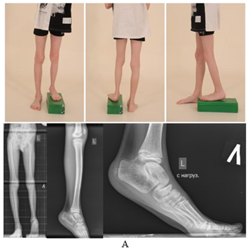 Изображение выглядит как одежда, башмак, обувь, высокие каблуки

Содержимое, созданное искусственным интеллектом, может быть неверным.