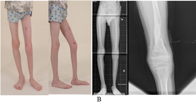 Изображение выглядит как сустав, рентгеновская пленка, обувь, Конечность

Содержимое, созданное искусственным интеллектом, может быть неверным.