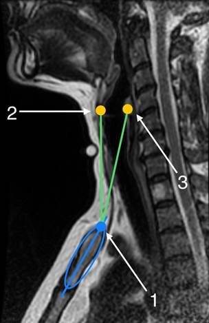 Изображение выглядит как медицинский, Медицинская визуализация, радиология, рентгенография

Автоматически созданное описание