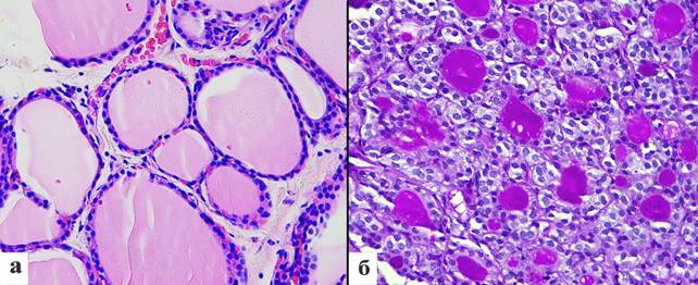Монтаж-2 (с ШИК-реакцией).jpg