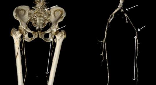 Изображение выглядит как скелет, насекомое

Содержимое, созданное искусственным интеллектом, может быть неверным.