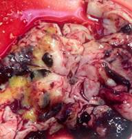 головной мозг