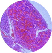 легкое(микро1)