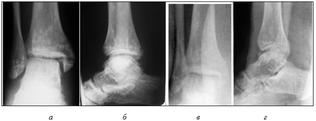 Изображение выглядит как рентгеновская пленка, Медицинская визуализация, радиология, рентгенография
Содержимое, созданное искусственным интеллектом, может быть неверным.