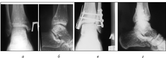 Изображение выглядит как рентгеновская пленка, Медицинская визуализация, радиология, Медицинская рентгенография
Содержимое, созданное искусственным интеллектом, может быть неверным.