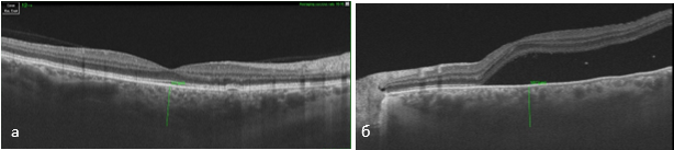 Изображение выглядит как снимок экрана, черный, Медицинская визуализация, рентгеновская пленка
Содержимое, созданное искусственным интеллектом, может быть неверным.